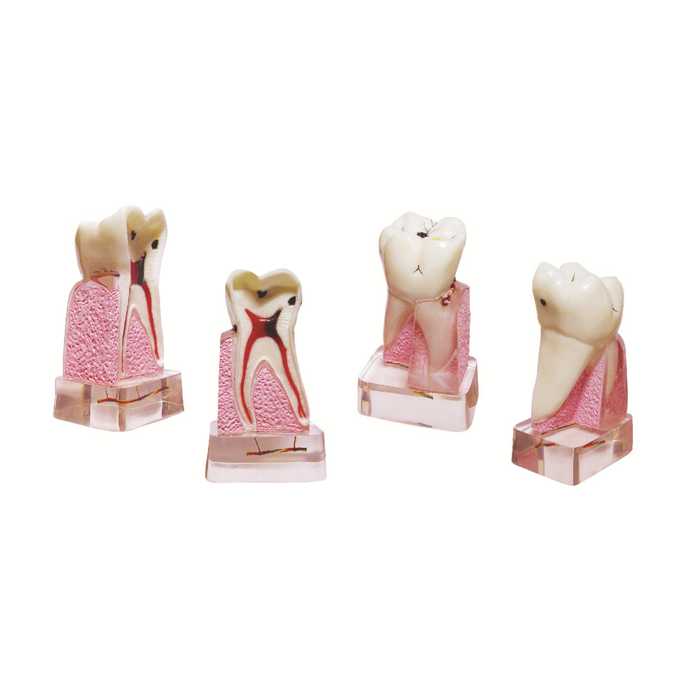 Modelo Patológico Dental, Mode - Medical Lab Supplies reseña y precio
