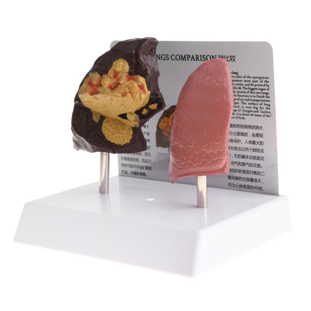 Modelo de Comparación de Pulmó - Medical Lab Supplies reseña y precio