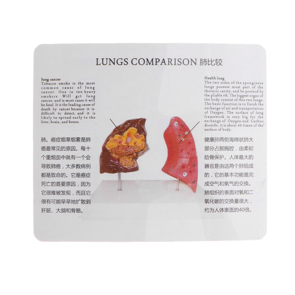 Modelo de Comparación de Pulmó - Medical Lab Supplies reseña y precio