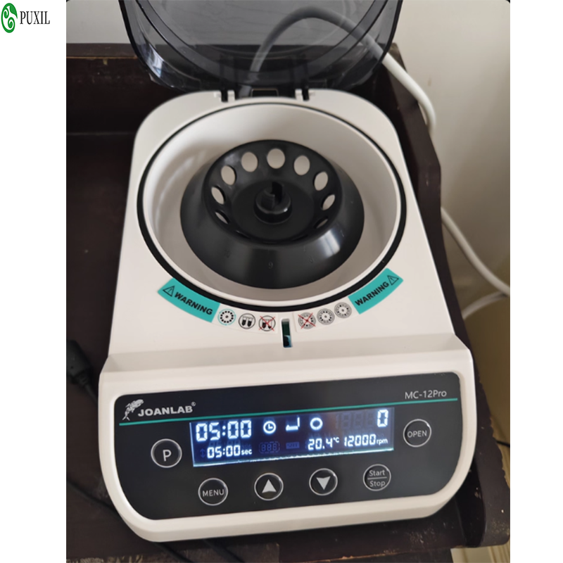 Centrífuga de plasma AB para l - Blood Collection Tube reseña y precio